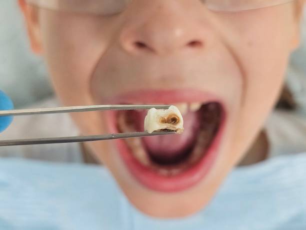 Best Tooth Pain Emergency Relief  in Brookneal, VA